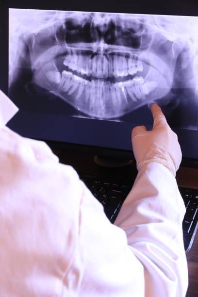 Best Emergency Tooth Extraction in Mebane, NC