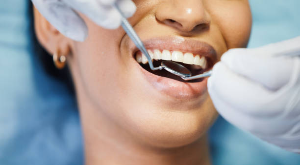 Best Emergency Treatment for Toothache in Mebane, NC